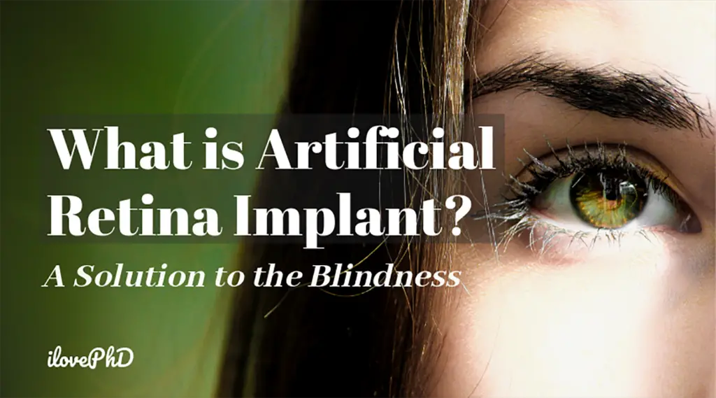 Powerful Artificial Retina Implant - A Solution to Blindness Now ...